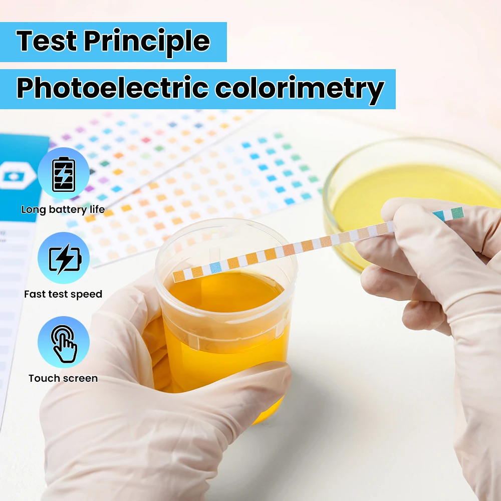 เครื่องวิเคราะห์ปัสสาวะสัตว์ S - Urine Analyzer Strip บทวิจารณ์และราคา